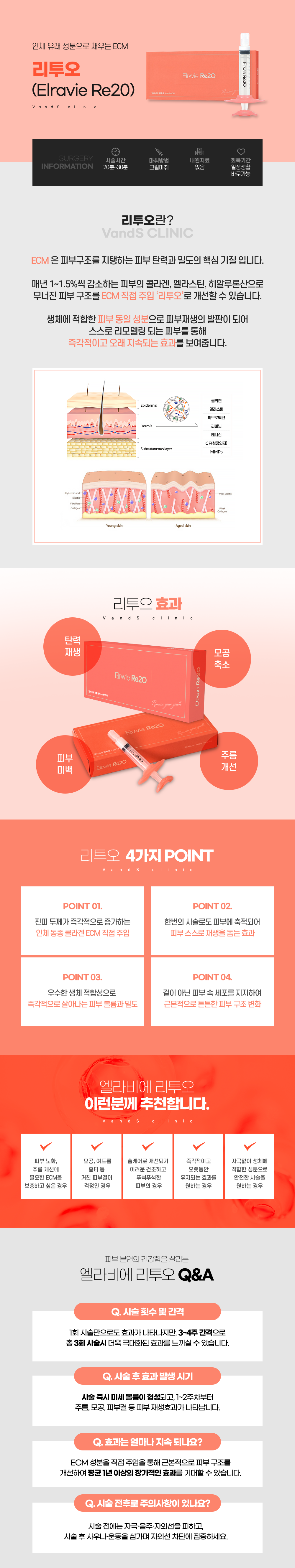리투오 시술안내 이미지1